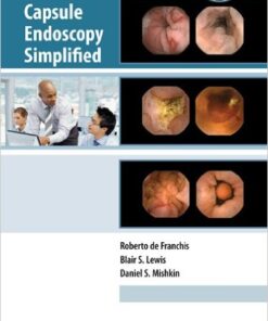 Capsule Endoscopy Simplified 1 Edition