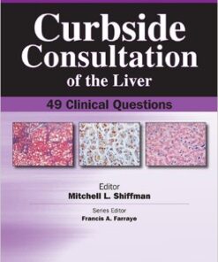 Curbside Consultation of the Liver: 49 Clinical Questions 1st Edition