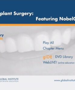 Guided Implant Surgery, Featuring NobelGuide