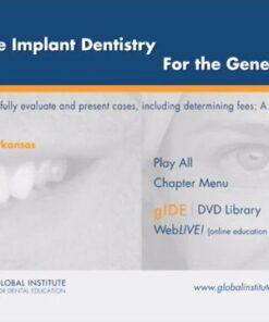 Restorative Implant Dentistry For the General Dentist