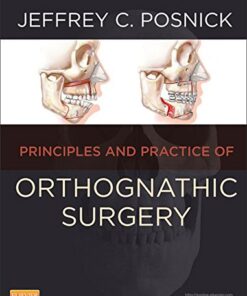 PDF & Videos of the Book Orthognathic Surgery: Principles and Practice