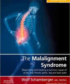 The Malalignment Syndrome: diagnosis and treatment of common pelvic and back pain, 2e 2nd Edition