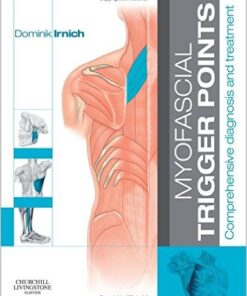Myofascial Trigger Points: Comprehensive diagnosis and treatment, 1e 1st Edition