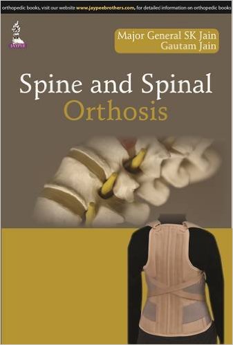 Spine and Spinal Orthosis 1st Edition