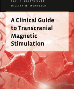 A Clinical Guide to Transcranial Magnetic Stimulation 1st Edition