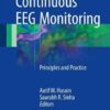 Continuous EEG Monitoring: Principles and Practice 1st ed. 2017 Edition PDF