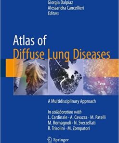 Atlas of Diffuse Lung Diseases 2017 : A Multidisciplinary Approach