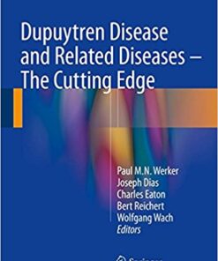 Dupuytren Disease and Related Diseases: The Cutting Edge
