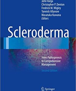 Scleroderma: From Pathogenesis to Comprehensive Management, 2nd Edition