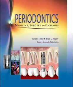 Periodontics : Medicine, Surgery and Implants.