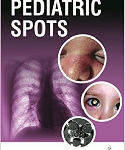 Pediatric Spots 1st Edition