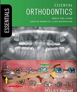 Essential Orthodontics (Essentials (Dentistry)) 1st Edition PDF