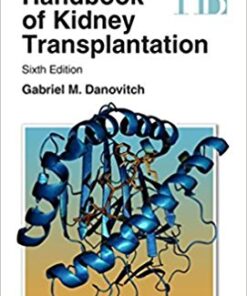 Handbook of Kidney Transplantation Sixth Edition PDF