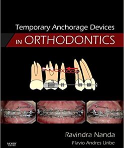 Temporary Anchorage Devices in Orthodontics, 1e 1st Edition PDF
