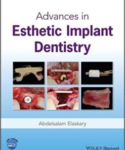 Advances in Esthetic Implant Dentistry 1st Edition PDF