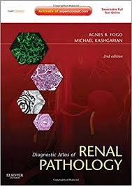 Diagnostic Atlas of Renal Pathology: Expert Consult - Online and Print, 2e