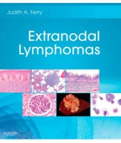 Extranodal Lymphomas: Expert Consult - Online and Print, 1e
