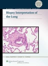 Biopsy Interpretation of the Lung (Biopsy Interpretation Series) 1 Har/Psc Edition