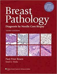 Breast Pathology: Diagnosis by Needle Core Biopsy