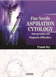 Fine Needle Aspiration Cytology: Interpretation and Diagnostic Difficulties 1st Edition