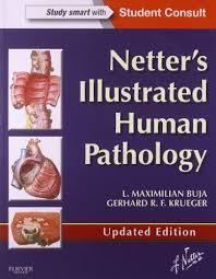 Netter's Illustrated Human Pathology Updated Edition: with Student Consult Access, 1e