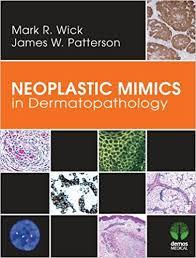 Neoplastic Mimics in Dermatopathology (Pathology of Neoplastic Mimics) 1st Edition