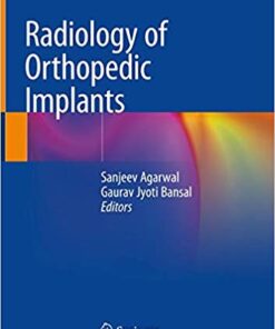 Radiology of Orthopedic Implants 1st ed. 2018 Edition PDF