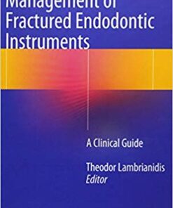 Management of Fractured Endodontic Instruments: A Clinical Guide 1st ed. 2018 Edition PDF