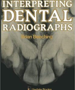 Interpreting Dental Radiographs Softcover reprint of the original 1st ed. 1981 Edition pdf