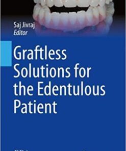 Graftless Solutions for the Edentulous Patient (BDJ Clinician’s Guides) 1st ed. 2018 Edition PDF