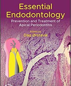 Essential Endodontology: Prevention and Treatment of Apical Periodontitis 3rd Edition PDF