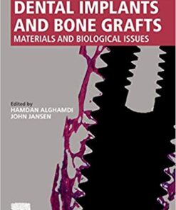 Dental Implants and Bone Grafts: Materials and Biological Issues 1st Edition PDF
