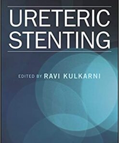 Ureteric Stenting 1st Edition PDF