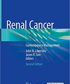 Renal Cancer: Contemporary Management 2nd ed. 2020 Edition PDF