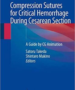 Compression Sutures for Critical Hemorrhage During Cesarean Section: A Guide by CG Animation 1st ed. 2020 Edition PDF