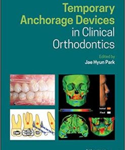 Temporary Anchorage Devices in Clinical Orthodontics 1st Edition PDF