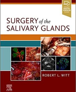 Surgery of the Salivary Glands 1st Edition PDF