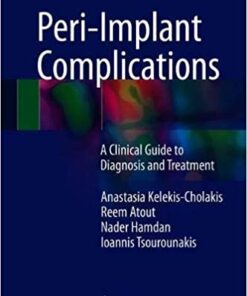 Peri-Implant Complications: A Clinical Guide to Diagnosis and Treatment 1st ed. 2018 Edition PDF
