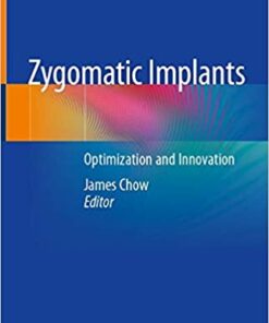 Zygomatic Implants: Optimization and Innovation 1st ed. 2020 Edition PDF