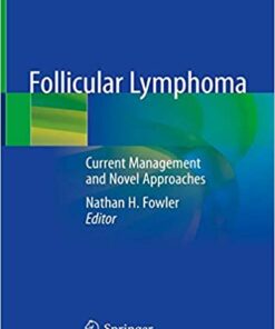 Follicular Lymphoma: Current Management and Novel Approaches 1st ed. 2020 Edition PDF
