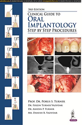 Clinical Guide to Oral Implantology: Step by Step Procedures PDF