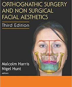 Fundamentals of Orthognathic Surgery and Non Surgical Facial Aesthetics: 3rd Edition 3rd Edition PDF
