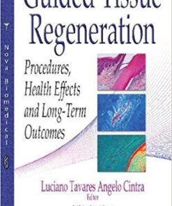 Guided Tissue Regeneration: Procedures, Health Effects and Long-term Outcomes PDF
