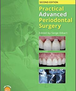 Practical Advanced Periodontal Surgery 2nd Edition PDF