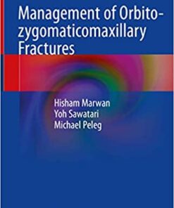 Management of Orbito-zygomaticomaxillary Fractures 1st ed. 2020 Edition PDF