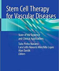 Stem Cell Therapy for Vascular Diseases: State of the Evidence and Clinical Applications 1st ed. 2021 Edition PDF