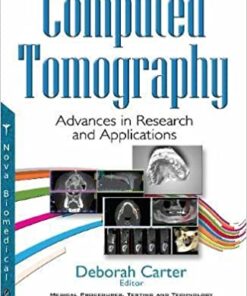 Computed Tomography: Advances in Research and Applications 1st Edition PDF