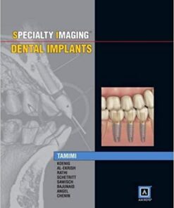 Specialty Imaging: Dental Implants 1st Edition PDF