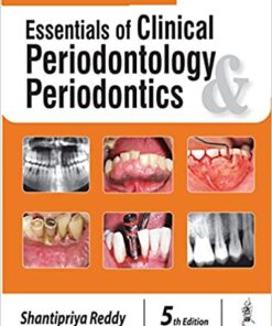 Essentials of Clinical Periodontology and Periodontics 5th Edition PDF