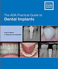 The ADA Practical Guide to Dental Implants 1st Edition PDF